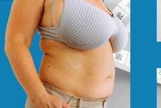 Para algunas mujeres, tener los senos grandes les provoca síntomas diarios.