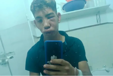 Así quedó la víctima tras la golpiza Foto: Gentileza Así quedó la víctima tras la golpiza Foto: Gentileza