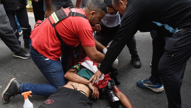 El fotógrafo Pablo Grillo continúa internado en el Hospital Ramos Mejía donde fue intervenido por segunda vez este viernes. Foto: EFE