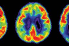 cinco factores que afectan la memoria cinco factores que afectan la memoria