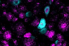 Foto: PATAPOUTIAN LAB, SCRIPPS RESEARC