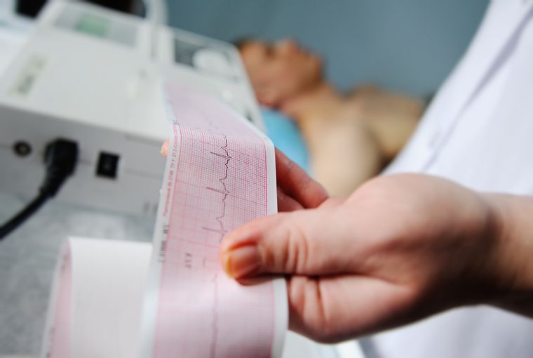 Hay algo más de muertes por infartos en mujeres que en hombres. Foto: shutterstock