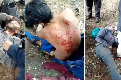 Las secuelas que les dejó el rayo a tres de las víctimas. Foto: gentileza. Las secuelas que les dejó el rayo a tres de las víctimas. Foto: gentileza.