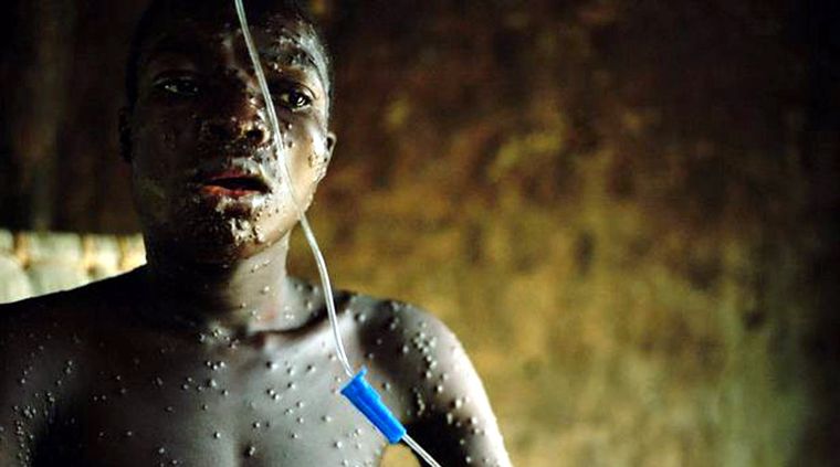 Los casos, normalmente de África, llegaron el Primer Mundo. Foto: TheGuardian.