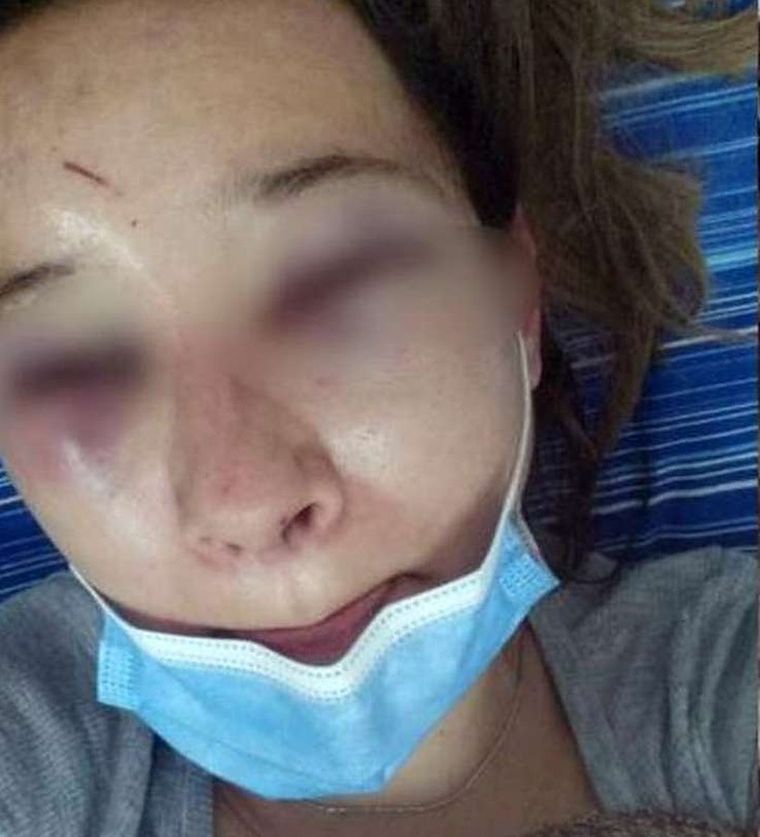 Así quedó la víctima tras el brutal ataque Foto: Diario Chaco