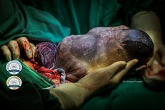 El milagro de la vida en tus manos Foto: Nora Dalmasso