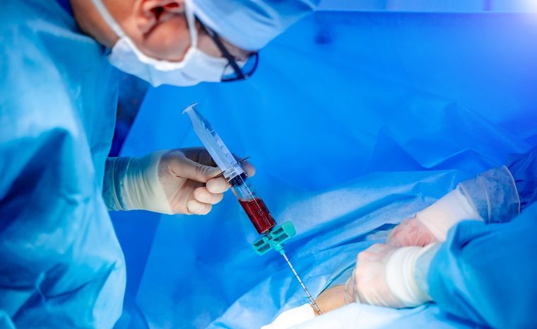 El centro inaugurado en la provincia a fines de 2022 solo realiza trasplantes autólogos Foto: Shutterstock