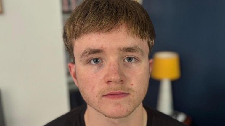 Judah Cousin, quien usa una pieza de cabello semipermanente, comenzó a perder su cabello a los 16 años y dice que el proceso fue &quot;agotador&quot;.