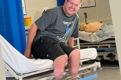 MDZol | Neil Hopper desarrolló sepsis después de enfermarse en un viaje de campamento. Foto: INSTAGRAM / BIONICSURGEON