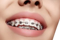 La mujer lastimó a su novio con los brackets y cuando llamó a la ambulancia se burlaron de ella