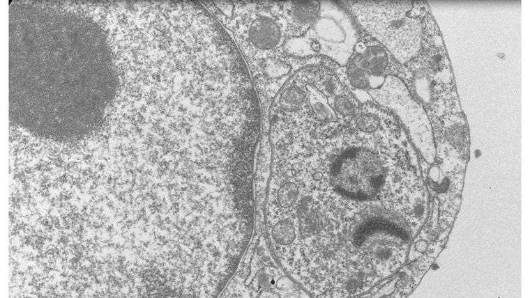 Una célula infectada con Trypanosoma cruzi, causante del mal de Chagas. Una célula infectada con Trypanosoma cruzi, causante del mal de Chagas.