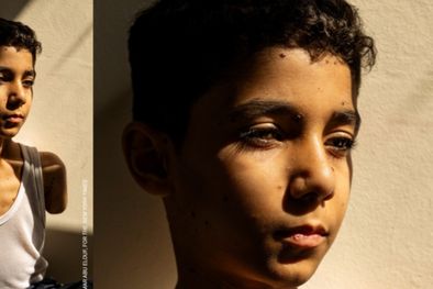 MDZol | La foto de un niño palestino mutilado ganó el World Press Photo 2025. Foto: BBC.