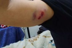 video: le disparo en la cara al marido de su expareja y quedo filmado video: le disparo en la cara al marido de su expareja y quedo filmado