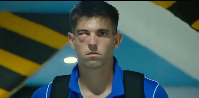 El arquero sufrió el golpe de un compañero y fue reemplazado sobre el final del partido.