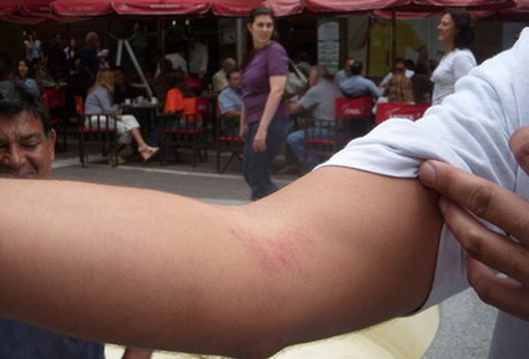 Un militante muestra los golpes que recibió en la peatonal.