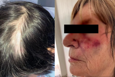 La mujer y su madre realizaron la denuncia tras el ataque en Mar del Plata.