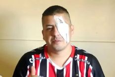 Jonathan Navarro con un parche en el ojo tras la represión policial en el Congreso Foto: NA Jonathan Navarro con un parche en el ojo tras la represión policial en el Congreso Foto: NA