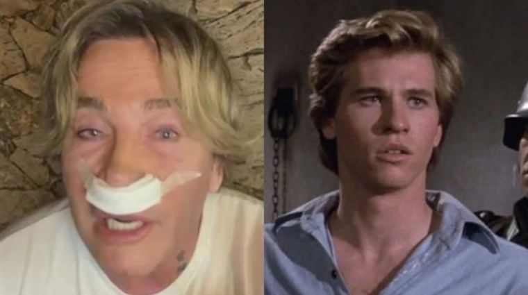 Con el mismo cirujano de Furia, Suller busca "levantar" su nariz para lucir su labio superior. Con el mismo cirujano de Furia, Suller busca "levantar" su nariz para lucir su labio superior.