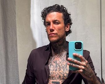 El antes y el después de una de las figuras más polémicas de la farándula argentina comenzó este martes. / Archivo MDZ