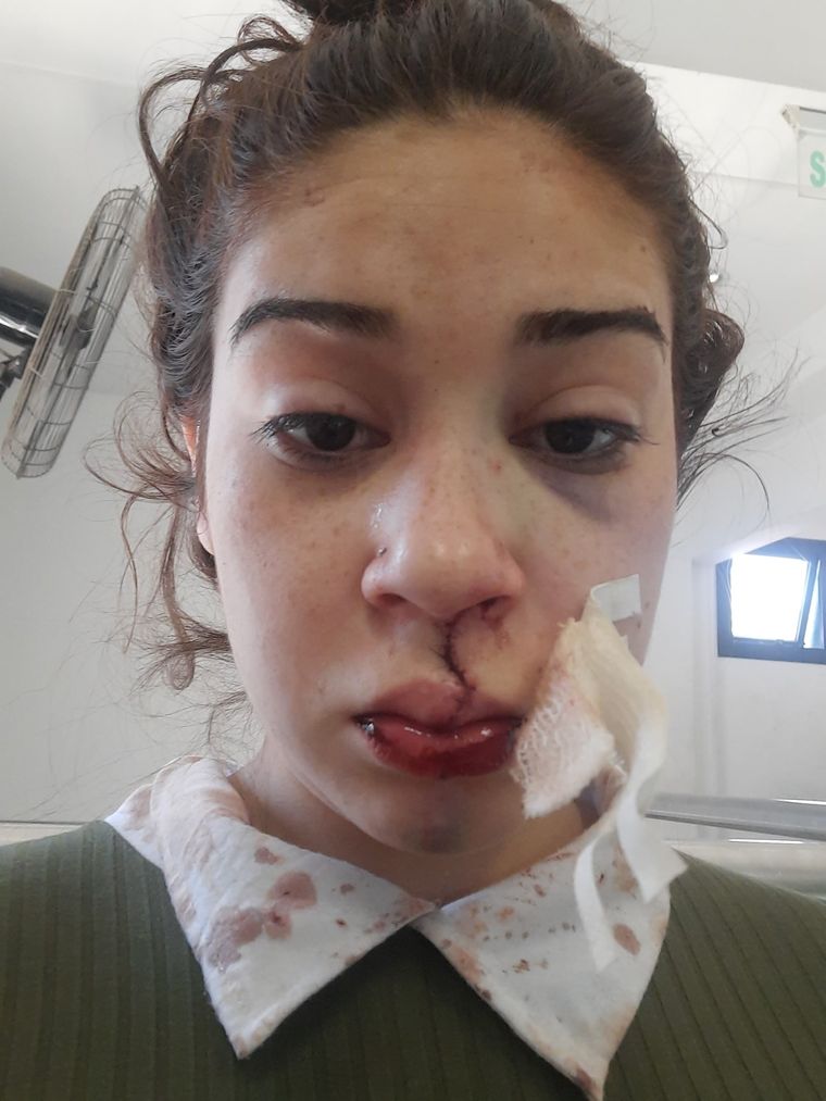 A la joven le volaron varias piezas dentales