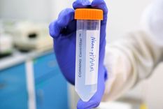 Nanopartículas desarrolladas para tratar el cáncer. Foto: RT