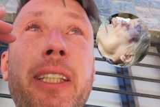 El dolor del influencer Pablo Pizzurno.