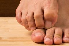 Los hongos en los pies son una infección que provoca picazón, entre otras cosas. Foto: Shutterstock