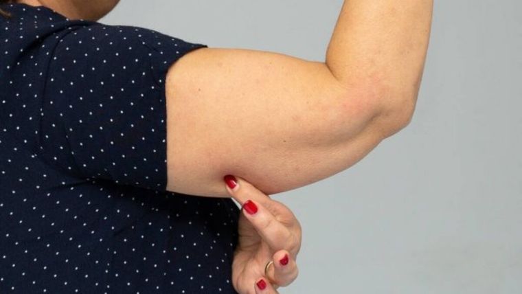 Ejercicios para tonificar brazos Foto: Archivo