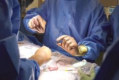 Foto: NYU LANGONE. La cirugía se realizó durante dos horas.