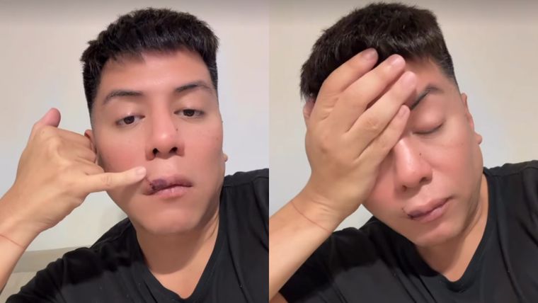 El influencer confesó que el incidente ocurrió durante un asado en casa de un íntimo amigo. El influencer confesó que el incidente ocurrió durante un asado en casa de un íntimo amigo.