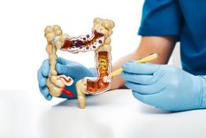 “Prevenir está al alcance de todos. Un estudio a tiempo puede marcar la diferencia”, aseguran los médicos.&nbsp;