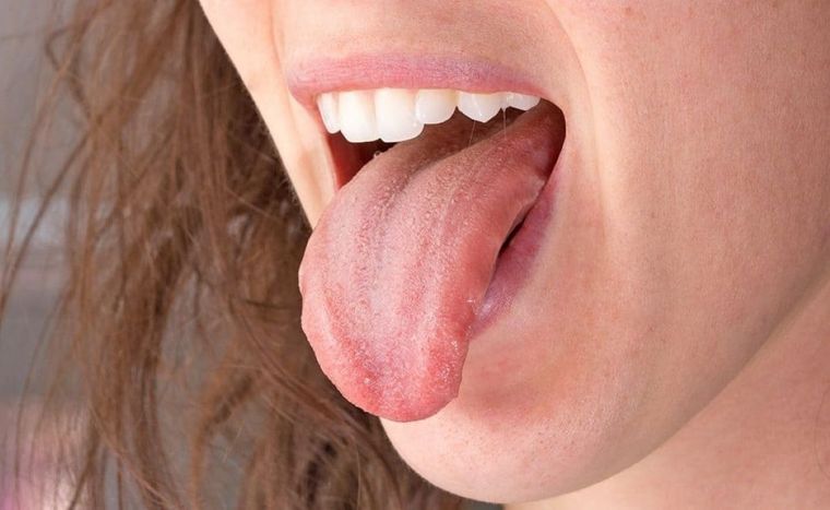 La lengua puede ser un indicador de tu salud. Foto: Archivo