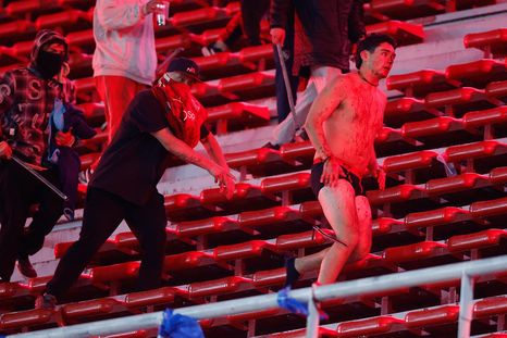 Los barras de Independiente están acusados de intento de homicidio. Los barras de Independiente están acusados de intento de homicidio.