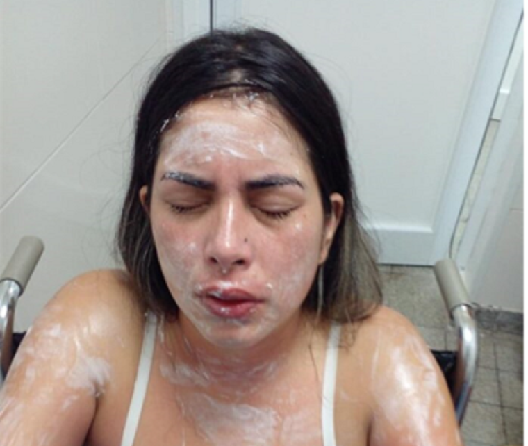 La víctima, instantes después del hecho.
