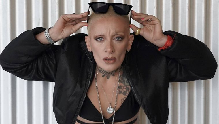 ¿Cómo es el retoque estético que se hizo Furia en su rostro?