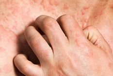 Foto: Salud para todos Foto: Salud para todos