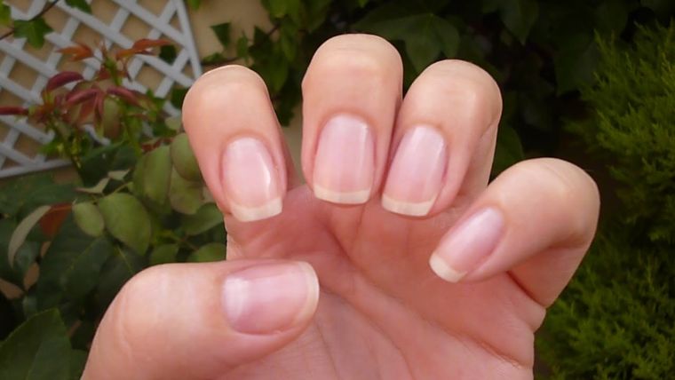 Práctico y efectivo: Remedios caseros para blanquear tus uñas