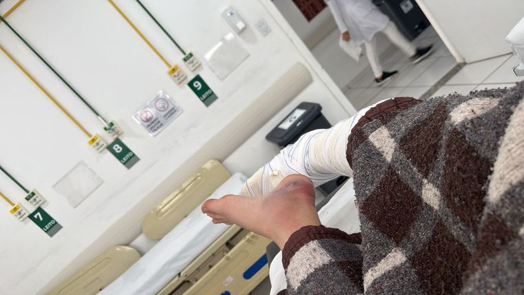 Rodrigo Sosa sufrió fractura de tobillo producto de una caída cuando intentaba escapar de las agresiones.