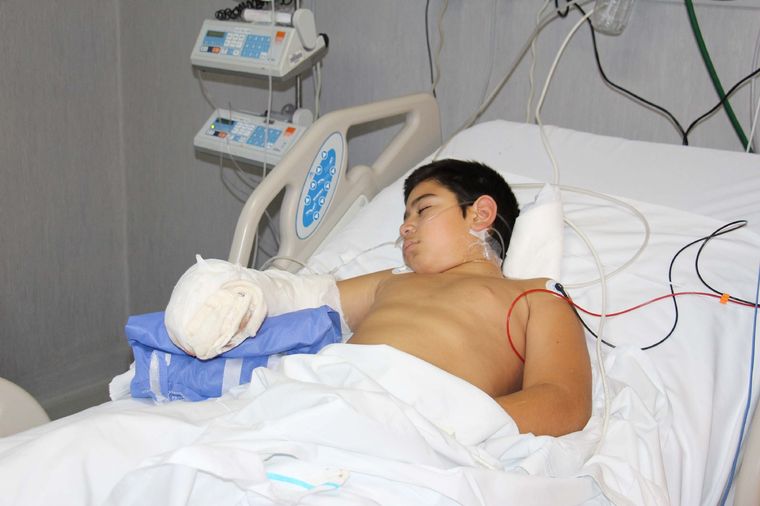 Thiago se cortó la mano con un hacha, pero pudieron reimplantársela