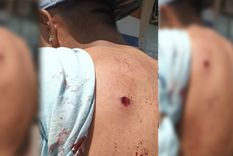 Uno de los heridos, con sangre en la espalda Foto: NA