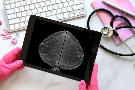 Argentina es uno de los países de América Latina con más casos de cáncer de mama.&nbsp;