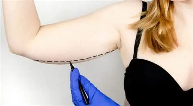 Los pacientes quedan muy conformes con el cambio en el volumen y la tensión del brazo. Los pacientes quedan muy conformes con el cambio en el volumen y la tensión del brazo.