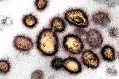 Nuevo coronavirus Sars-Cov-2.