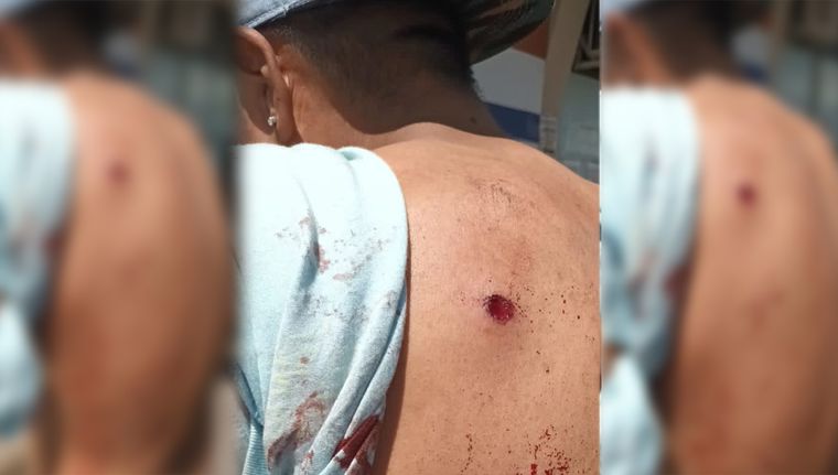 Uno de los heridos, con sangre en la espalda Foto: NA