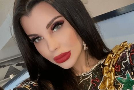 El antes y después de Charlotte Caniggia. El antes y después de Charlotte Caniggia.