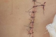 Una de las heridas que le dejó en el cuerpo a su pareja Una de las heridas que le dejó en el cuerpo a su pareja