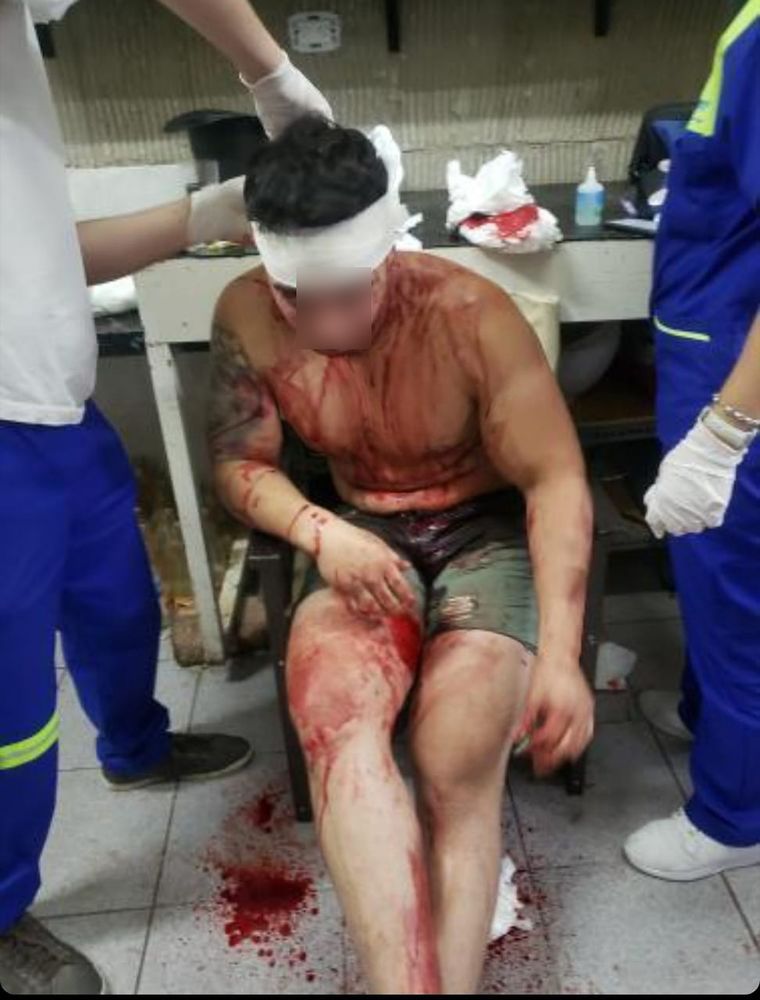 Federico al ser atendido por los médicos. Le pusieron 9 puntos en la cabeza