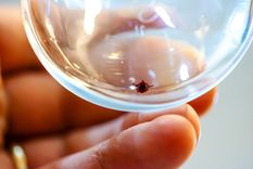 Adiós a los parásitos que hacen sufrir a tu mascota. Foto: Fuente: Shutterstock