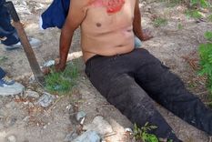 Uno de los heridos en el enfrentamiento de La Matanza Foto: Noticias Argentinas