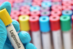 alerta en tucuman por legionella: ¿que pasa en mendoza?